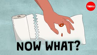 what should you do if you accidentally cut off your finger jason hoellwarth