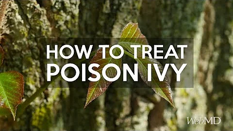 How to Treat Poison Ivy | WebMD