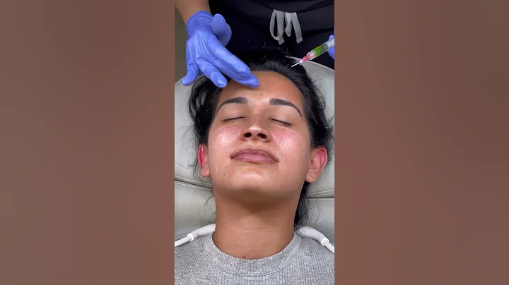 BioRePeel - Best Way To Get Rid Of Pigmentation, Fine Lines, Wrinkles For Smooth Glass Skin