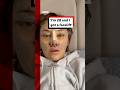 "I'm 28 and I got a facelift". #Facelift #PlasticSurgery #BBCNews