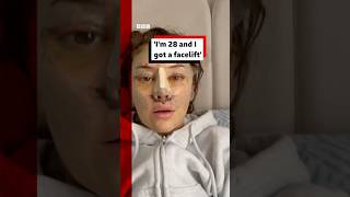 Im 28 And I Got A Facelift.