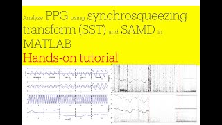 Analyze PPG using synchrosqueezing transform and SAMD in MATLAB: Hands-on tutorial