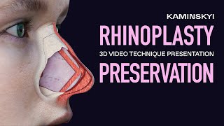 PRESERVATION PUSH DOWN RHINOPLASTY BY CLOSED TECHNIQUE / KAMINSKYI