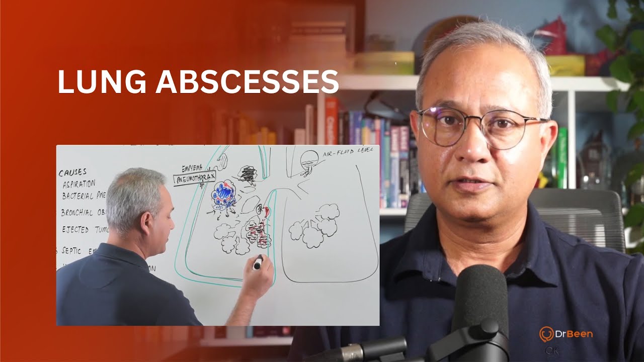 Абсцессы легких