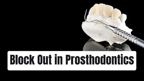 Block Out in Prosthodontics || Dental || Mind Musings