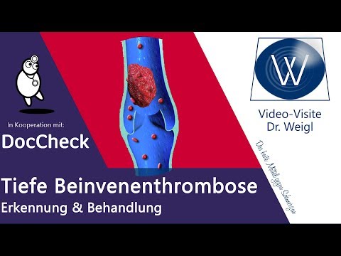 Video: Tiefe Venenthrombose Der Unteren Extremitäten - Symptome Und Behandlung