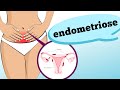 ENDOMETRIOSE: COMO IDENTIFICAR?