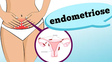 Que remédio caseiro é bom para endometriose?