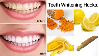 Teeth Whitening Hacks | Teeth Whitening At Home In Urdu/Hindi.