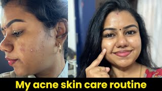 Best skin care products for oily acne prone skin | my current skin care routine | How I cured acne