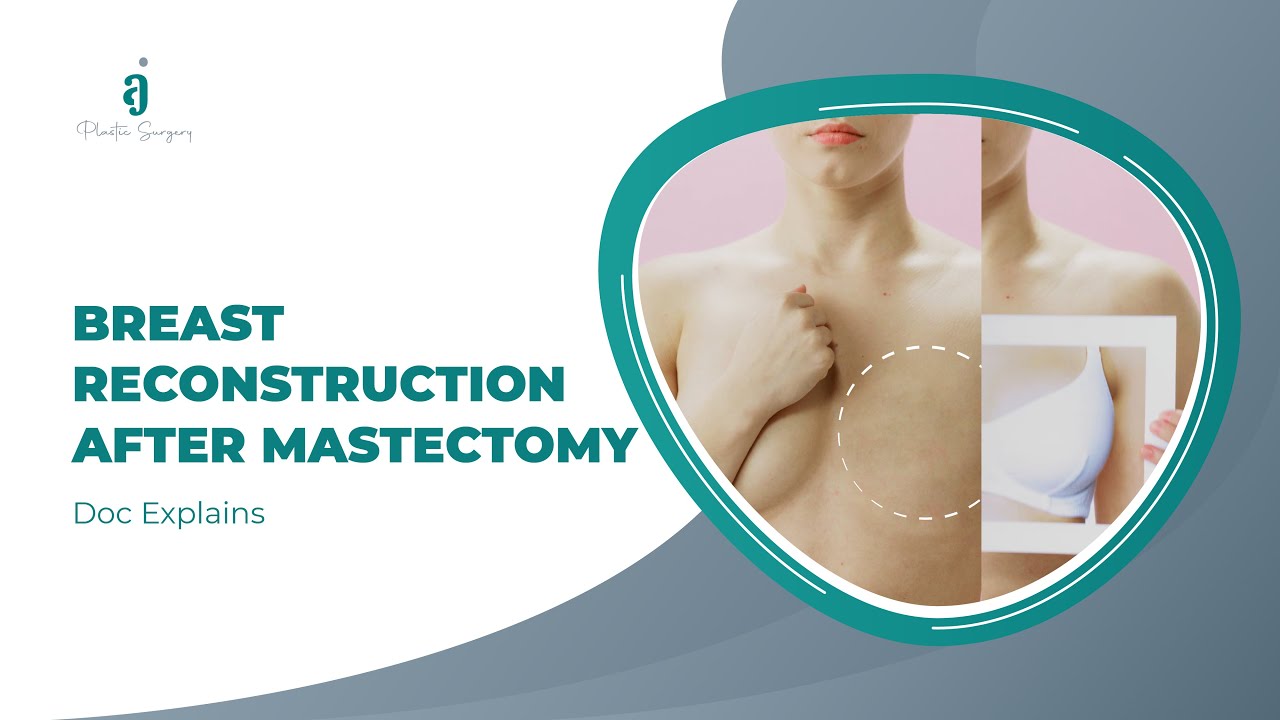 Breast Reconstruction After Mastectomy Youtube