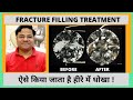 How to Identify Fracture-Filled Diamond | DU-GEMOLOGY