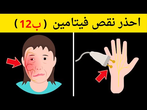 10 علامات تحذيرية أنك تعاني من نقص فيتامين ب 12 تحذير الأطباء من نقص ب 12 على حياتك