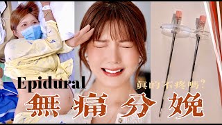 ALL YOU NEED TO KNOW ABOUT EPIDURAL | 无痛分娩真的不痛吗？关于无痛你需要知道的一切