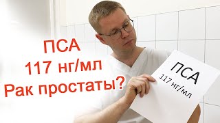 ПСА 117 нг/мл – Рак простаты? / Доктор Черепанов