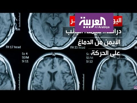 فيديو: من اخترع اليوم العالمي للعسراء