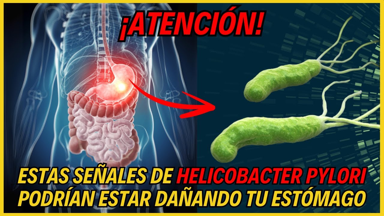 "¡ALERTA! Identifica estas SEÑALES de Helicobacter Pylori y Protege tu Estómago"