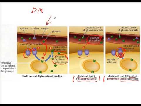 Video: L'insulina Traduce Uno Stile Di Vita Sfavorevole In Obesità