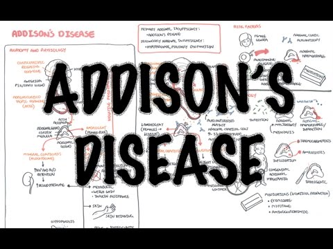 Download Addison's Disease - Overview (clinical features, pathophysiology, investigations, treatment)