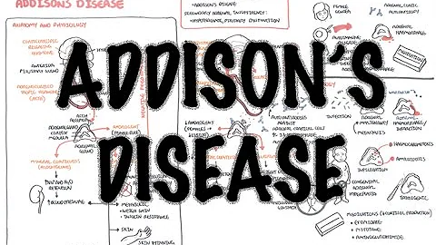 Addison's Disease - Overview (clinical features, p...