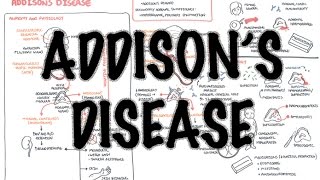 Addison's Disease  Overview (clinical features, pathophysiology, investigations, treatment)