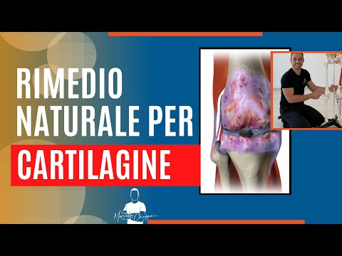 Video: 3 modi per curare la cartilagine del ginocchio