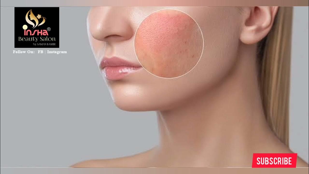 7 formas de reducir la histamina naturalmente Alergias, Deficiencia de magnesio,