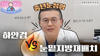 [성형외과 전문의 Q&amp;A] 중년눈성형, 하안검vs 눈밑지방재배치 정해드립니다