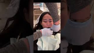 I Got All 4 Of My Wisdom Teeth Removed Day 1