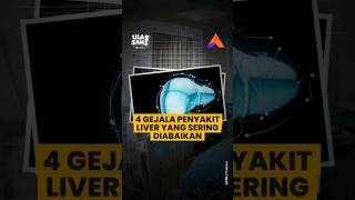 4 GEJALA PENYAKIT LIVER YANG SERING DIABAIKAN