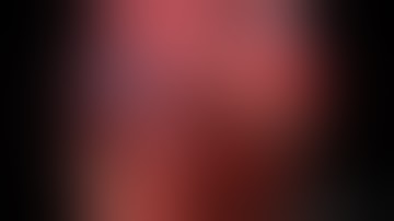 Subxiphoid vats right lower lobectomy for pulmonary sequestration