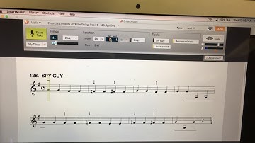 Basic Smart Music Features