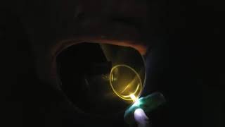 Ferrocell One Light Magnet on its Side