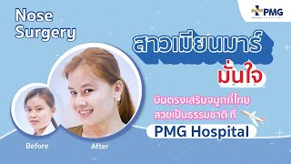 ความประทับใจจากผู้เข้ารับบริการ ศัลยกรรมเสริมจมูก | PMG Hospital