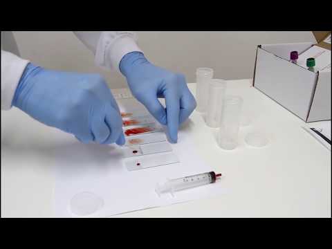 Vídeo: Esfregaço De Sangue: Objetivo, Procedimento E Resultados