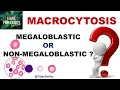MACROCYTOSIS.   Causes, Mechanism &amp; Approach