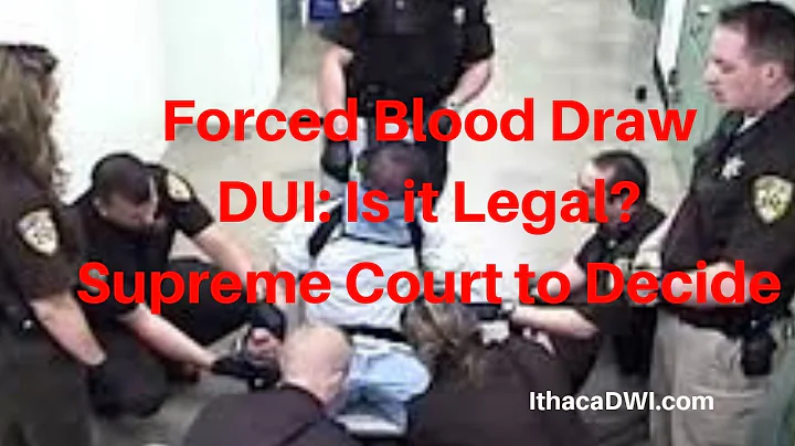 Supreme Court to Decide Forced Blood Draw DUI