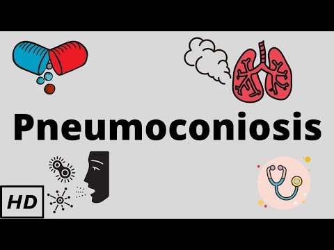 Pneumoconiosis, Causes, Signs and Symptoms, Diagnosis and Treatment.