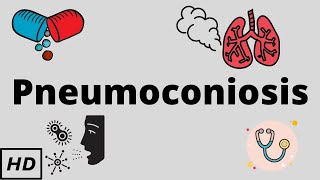 Pneumoconiosis, Causes, Signs and Symptoms, Diagnosis and Treatment.