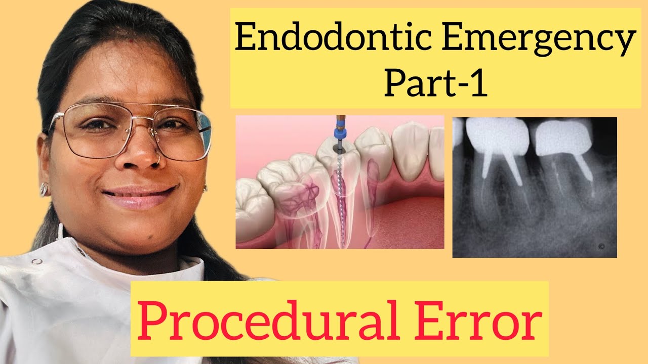 Why EndodonticErrors Are So Common| endodontic emergency - YouTube