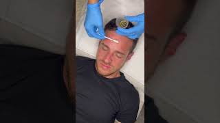 PEELS 101 - Part 4: When to Get a Peel
