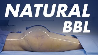 Achieving a Natural Shape with a BBL Surgery