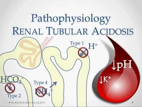 Renal Tubular Acidosis - USMLE STep 2 Review