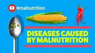 Diseases Caused by Malnutrition - SCURVY, RICKETS, BERIBERI, PELLAGRA