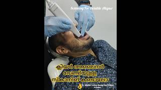 intraoral Scanning for Clear Aligner #dentist #shorts #ഡെന്റൽ #smilemakeover #smile #naturalsmile