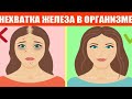 Недостаток железа. Что нужно для усвоения железа