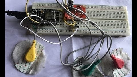 IoT Based ECG and Heart rate Monitoring with AD8232 ECG Sensor & ESP8266.