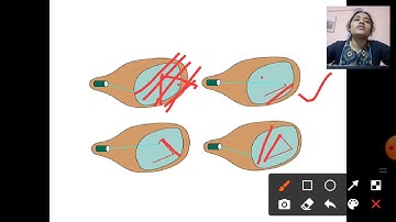 RANDOM SCAN DISPLAY / CGM / 5TH SEM / IT
