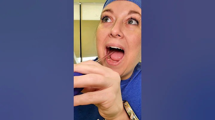 You get tonsil stones? Have patients dealing with these? Check out the Oravix Tonsil Stone Vacuum!