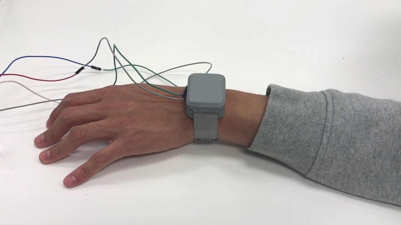 The WalkBand is a vibrating device that provides a cue for Parkinson's patients to overcome freezing of gait and improve gait mechanics.